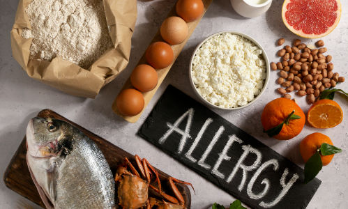 Food Allergies